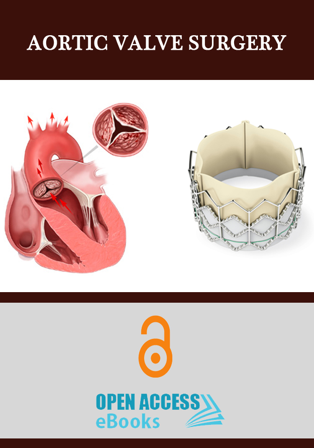 aortic-valve-surgery