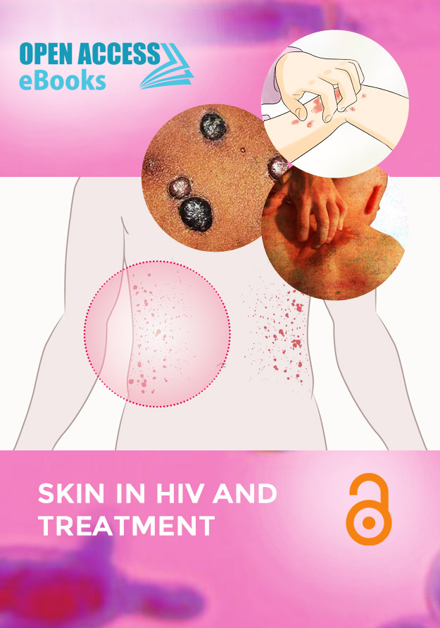 Skin in HIV and Treatment